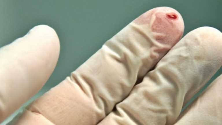 SAĞLIK HİZMETLERİ İLE İLİŞLKİLİ ENFEKSİYONLARIN ÖNLENMESİ VE KESİCİ DELİCİ ALET YARALANMALARINDAN KORUNMA